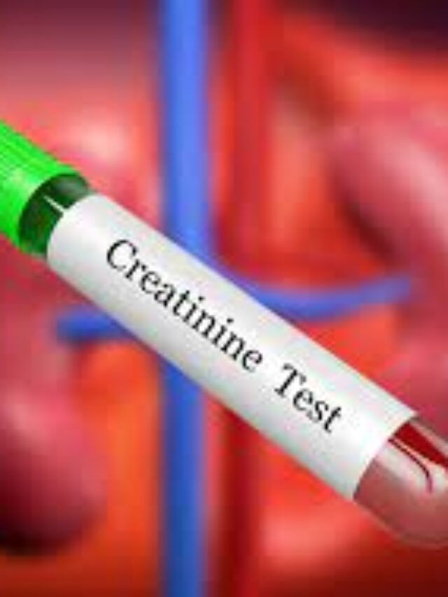 Is Your Engine Running Smooth? The Creatinine Test – Your Kidney’s Report Card
