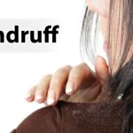 Dandruff