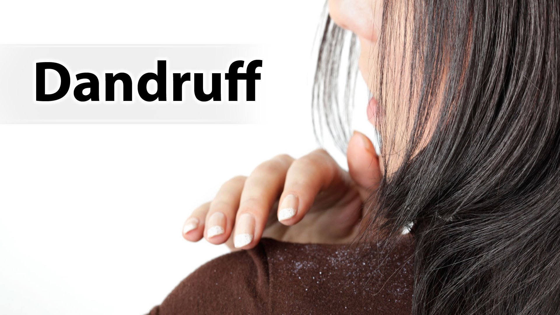 Dandruff